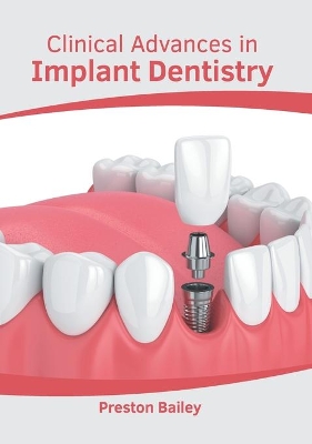 Clinical Advances in Implant Dentistry book