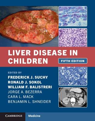 Liver Disease in Children book