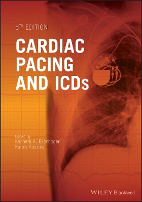 Cardiac Pacing and ICDs book