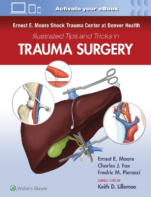 Ernest E. Moore Shock Trauma Center at Denver Health Illustrated Tips and Tricks in Trauma Surgery book