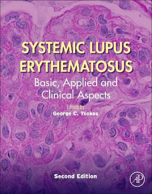 Systemic Lupus Erythematosus: Basic, Applied and Clinical Aspects book