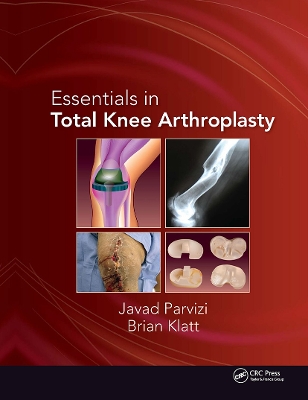 Essentials in Total Knee Arthroplasty book