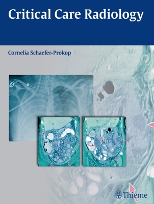 Critical Care Radiology book