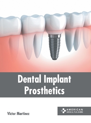 Dental Implant Prosthetics book