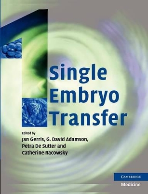 Single Embryo Transfer by Jan Gerris