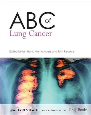 ABC of Lung Cancer book