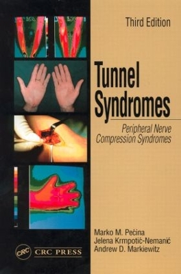 Tunnel Syndromes book