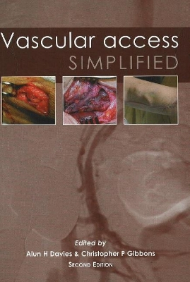 Vascular Access Simplified book