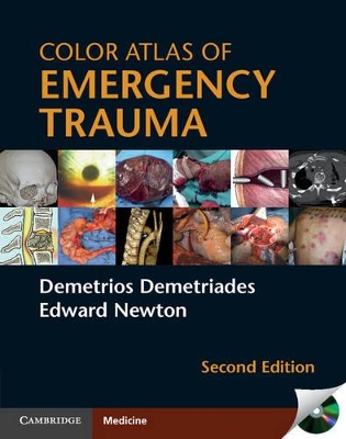 Color Atlas of Emergency Trauma book