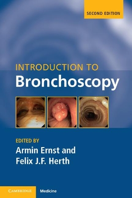 Introduction to Bronchoscopy book