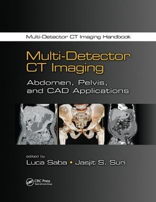 Multi-Detector CT Imaging: Abdomen, Pelvis, and CAD Applications by Luca Saba