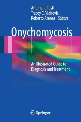 Onychomycosis book
