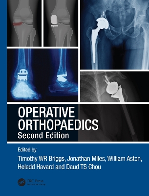 Operative Orthopaedics by Timothy WR Briggs