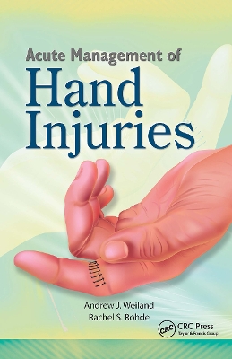 Acute Management of Hand Injuries book