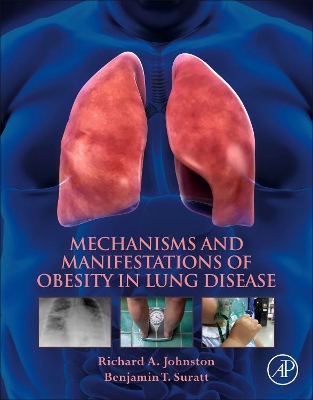 Mechanisms and Manifestations of Obesity in Lung Disease book