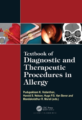 Textbook of Diagnostic and Therapeutic Procedures in Allergy book
