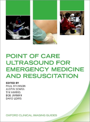 Point of Care Ultrasound for Emergency Medicine and Resuscitation book