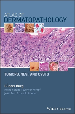 Atlas of Dermatopathology: Tumors, Nevi, and Cysts book