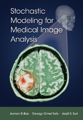 Stochastic Modeling for Medical Image Analysis book