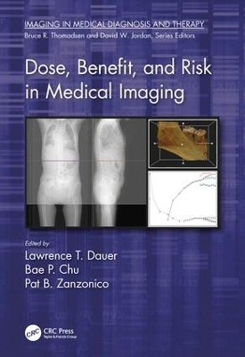 Dose, Benefit, and Risk in Medical Imaging book