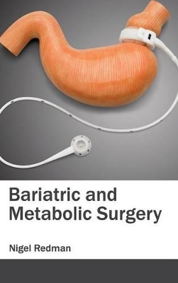 Bariatric and Metabolic Surgery book