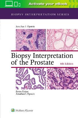 Biopsy Interpretation of the Prostate book