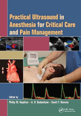 Practical Ultrasound in Anesthesia for Critical Care and Pain Management book