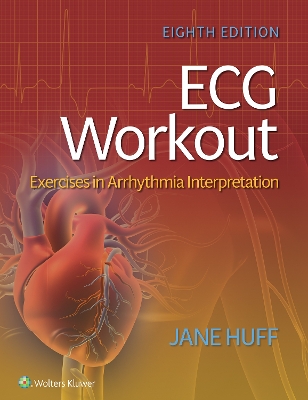 ECG Workout: Exercises in Arrhythmia Interpretation book