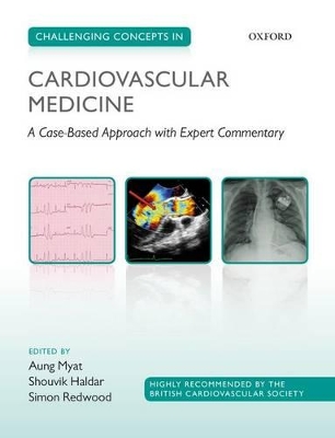 Challenging Concepts in Cardiovascular Medicine book