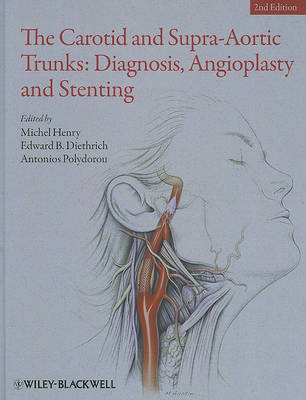 Carotid and Supra-Aortic Trunks book