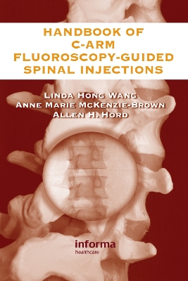 Handbook of C-Arm Fluoroscopy-Guided Spinal Injections book