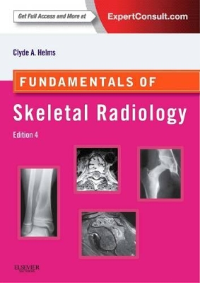 Fundamentals of Skeletal Radiology by Clyde A. Helms