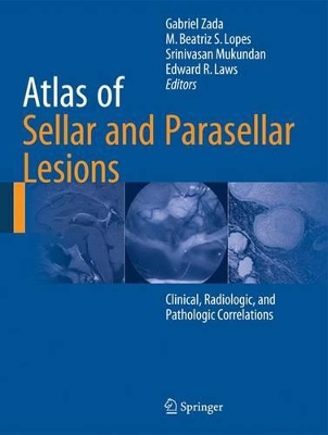 Atlas of Sellar and Parasellar Lesions by Gabriel Zada