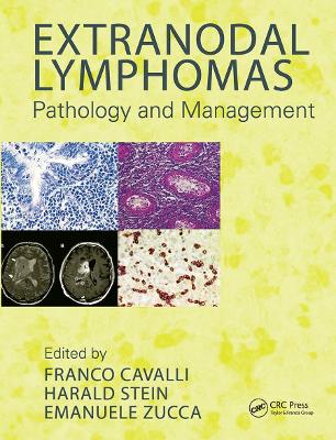 Extranodal Lymphomas: Pathology and Management book