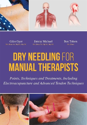 Dry Needling for Manual Therapists book