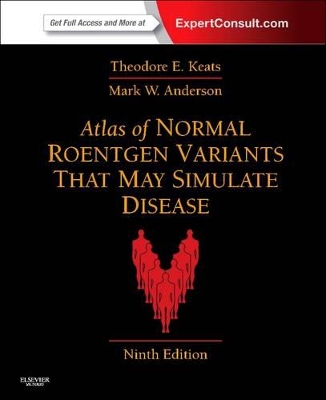 Atlas of Normal Roentgen Variants That May Simulate Disease book