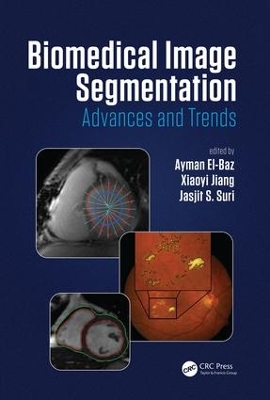 Biomedical Image Segmentation by Ayman El-Baz