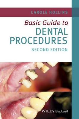 Basic Guide to Dental Procedures by Carole Hollins
