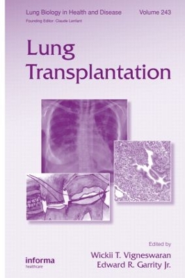 Lung Transplantation book