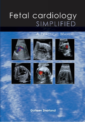 Fetal Cardiology Simplified book