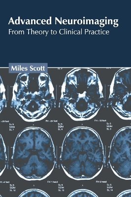 Advanced Neuroimaging: From Theory to Clinical Practice book