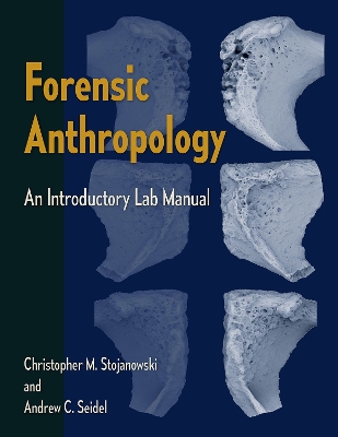 Forensic Anthropology: An Introductory Lab Manual book