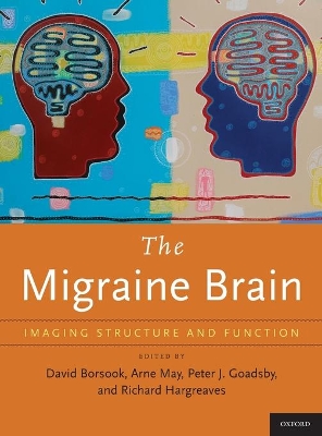 Migraine Brain book
