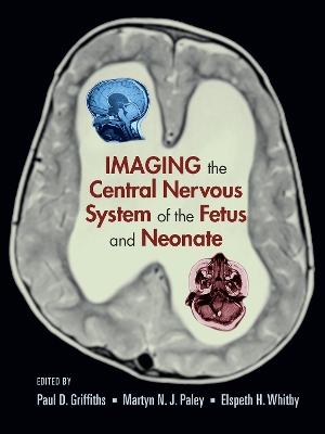 Imaging the Central Nervous System of the Fetus and Neonate book
