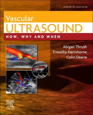 Vascular Ultrasound book