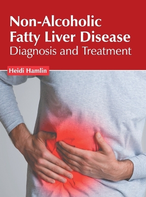 Non-Alcoholic Fatty Liver Disease: Diagnosis and Treatment book