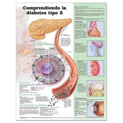 Understanding Type 2 Diabetes Anatomical Chart in Spanish (Comprendiendo la diabetes tipo 2) by Anatomical Chart Company