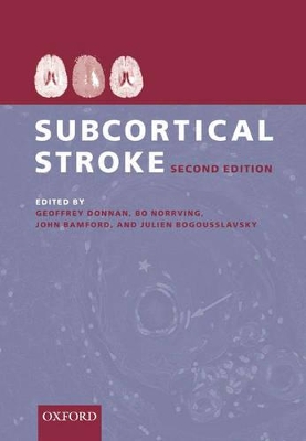 Subcortical Stroke book