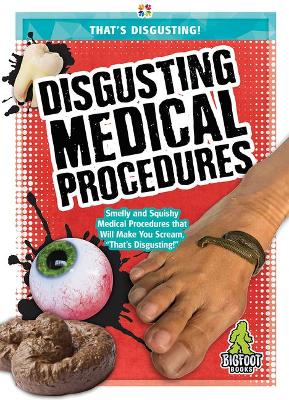 Disgusting Medical Procedures book