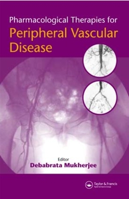 Pharmacological Therapies for Peripheral Vascular Disease by Debabrata Mukherjee